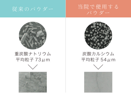 当院で使用するパウダーは炭酸カルシウム（平均粒子54μm）