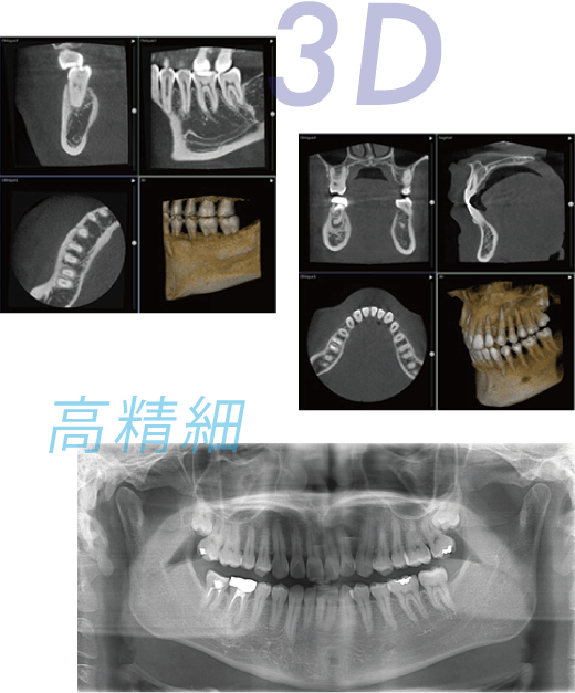 3D 高精細